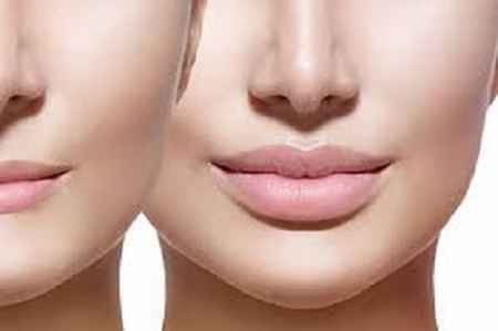 آب کردن چربی های صورت و غبغب در سایت علی نوروزی