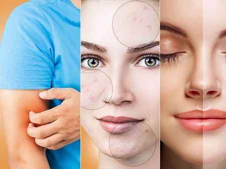 تغذیه مناسب برای مشکلات پوستی در سایت علی نوروزی